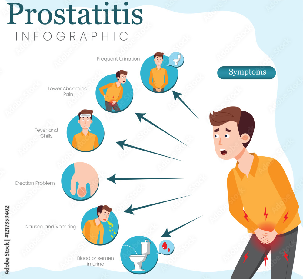Infographic of Prostatitis Symptoms Key Signs and Indicators Illustrated Infographic of Prostatitis Symptoms Key Signs and Indicators Illustrated