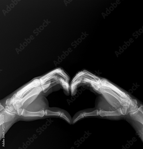 x-ray image of hands making heart symbols. Valentine day concept