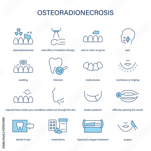 Osteoradionecrosis symptoms, diagnostic and treatment vector icon set. Medical icons.