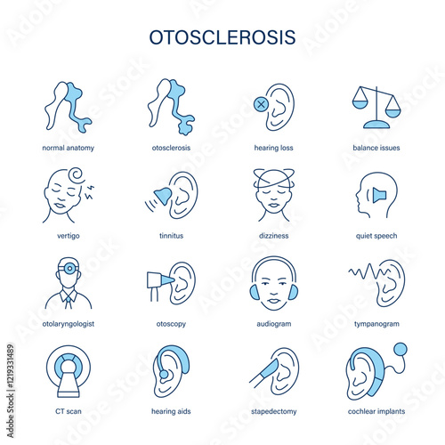 Otosclerosis symptoms, diagnostic and treatment vector icon set. Medical icons.