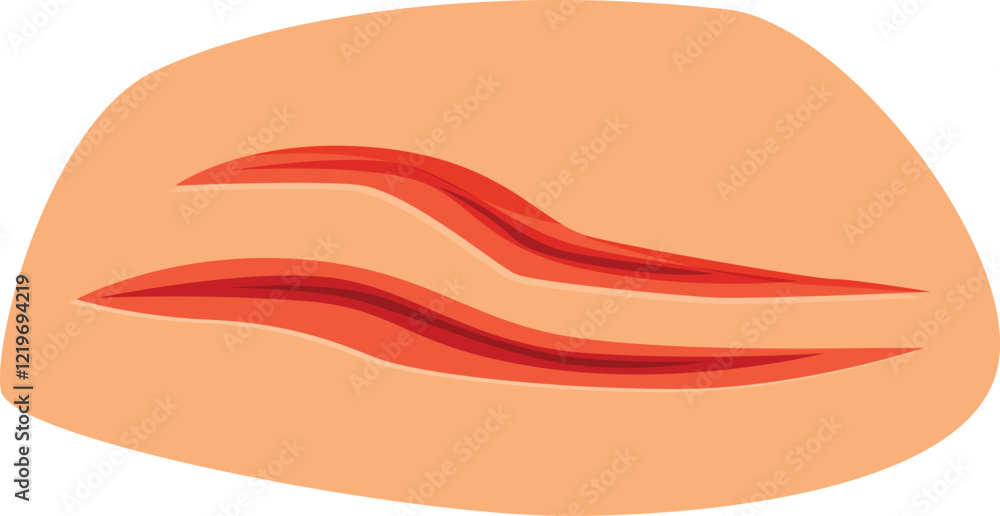 Muscle injury showing two red strained muscle fibers on orange skin, concept of muscle strain or tear Muscle injury showing two red strained muscle fibers on orange skin, concept of muscle strain or tear