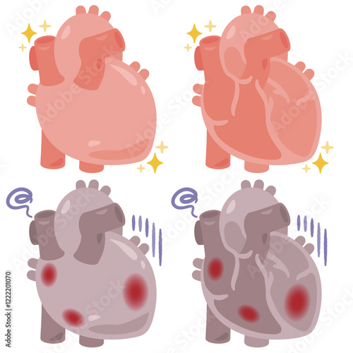 健康でキレイな心臓と炎症が起きた不健康な心臓のイラスト