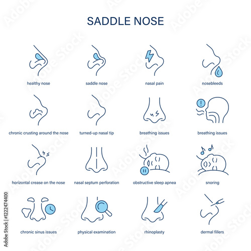 Saddle Nose symptoms, diagnostic and treatment vector icon set. Medical icons.