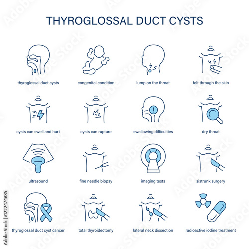 Thyroglossal Duct Cysts symptoms, diagnostic and treatment vector icon set. Medical icons.