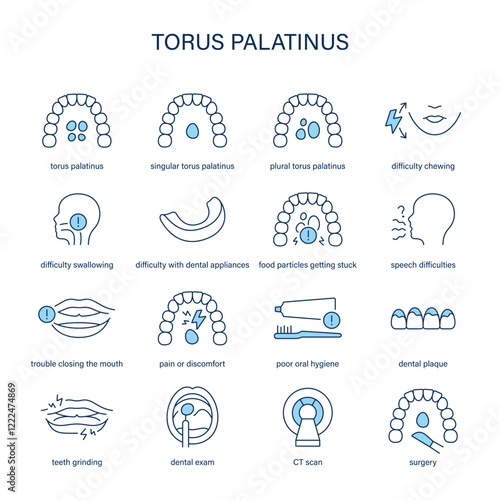Torus Palatinus symptoms, diagnostic and treatment vector icon set. Medical icons.