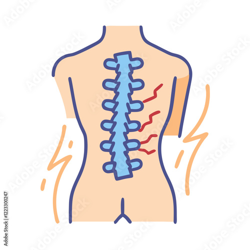 Spinal Cord Injury and Back Pain Medical Diagram in SVG