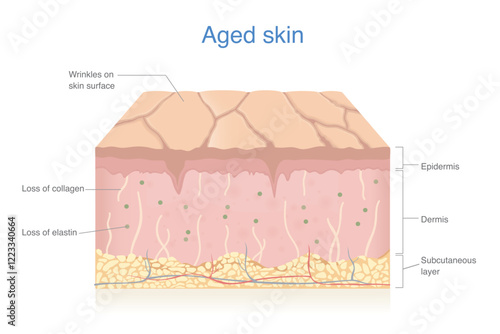 Aged skin layer isolated on white. Wrinkles and dryness on skin surface. Loss of collagen and elastin.  Skin problems in epidermis and dermis from aging.