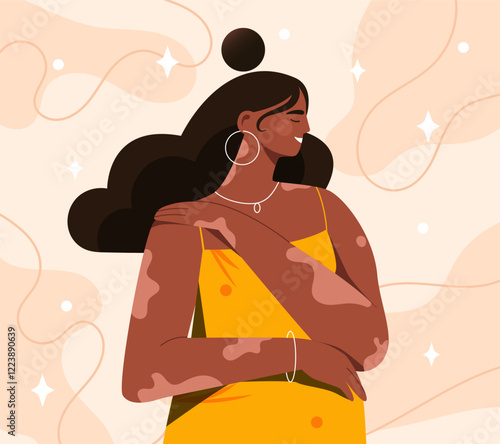 Illustration of a woman with vitiligo wearing a yellow dress, smiling confidently. Abstract background with flowing lines and sparkles. Empowerment concept. Vector illustration.