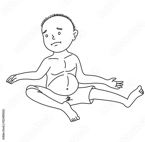 Science of hand drawn vector kwashiorkor disease outline.