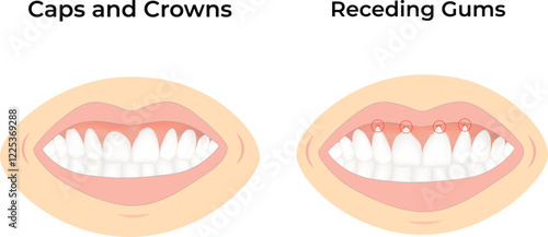 Caps Crowns and Receding Gums Design Vector Illustration