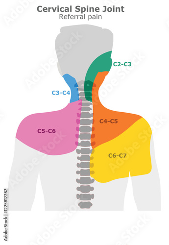 Cervical spine joint referral pain areas, Head, neck shoulder vertebral description spline. c1, c2, c3, c4, c5, c6, c7 joints location. Vector illustration