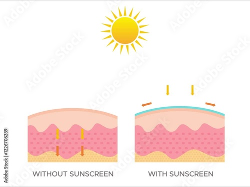 Comparison of skin using sunscreen with normal skin. Protection of the skin from ultraviolet radiation