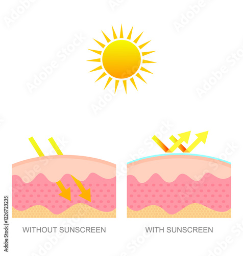 Comparison of skin using sunscreen with normal skin. Protection of the skin from ultraviolet radiation
