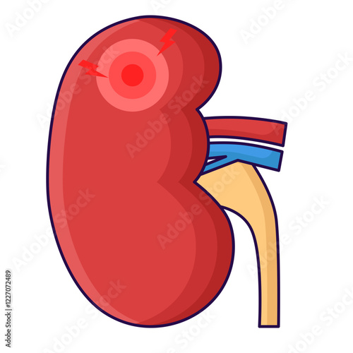 Kidney disease
