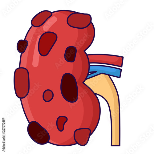 Kidney disease