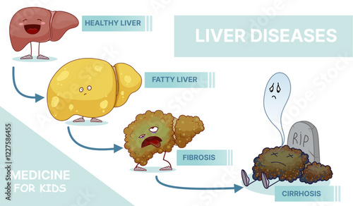 Liver diseases. Medical infographic. Medicine for kids. Illustrations for kids. Vector illustration. 