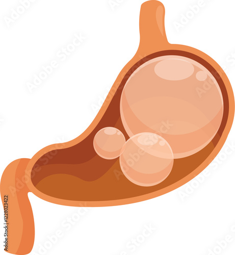 Human stomach full of gas causing abdominal distension and acid reflux, digestive problems concept