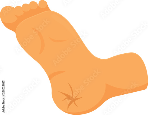 Cracked heel with dry skin, causing discomfort and requiring moisturizing treatment