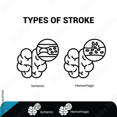 Brain stroke icon - ischemic and hemorrhagic icon, Vector illustration