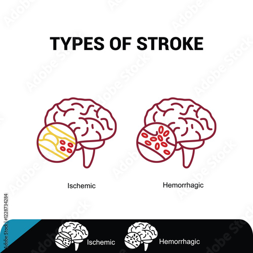 Brain stroke icon - ischemic and hemorrhagic icon, Vector illustration