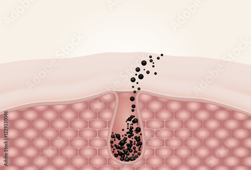 Dirt and ingrained the skin cell face clogging. The cause of acne and dermatitis. 