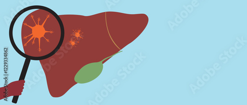 Liver with malignant tumor as oncology concept, flat vector stock illustration or copy space template with liver cancer