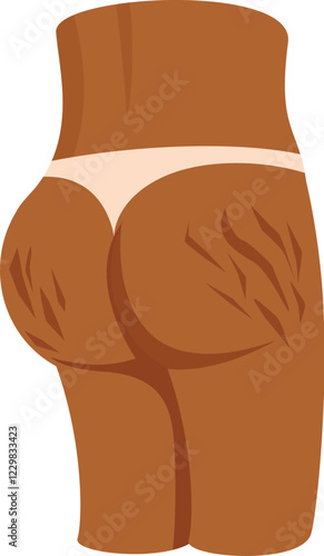 Female body with stretch marks on buttocks, concept of cellulite, overweight and skin care