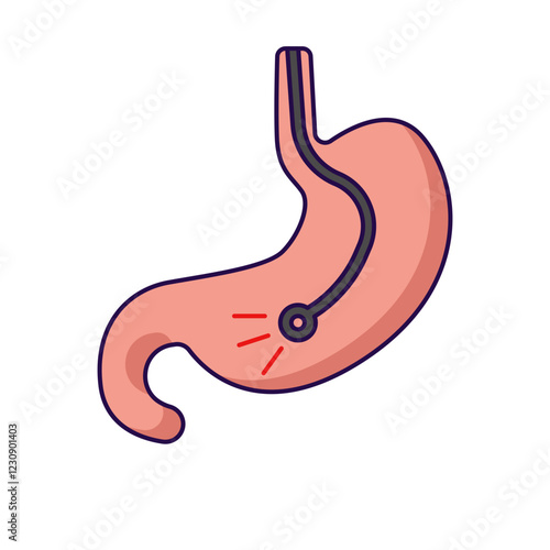 Endoscopy treatment