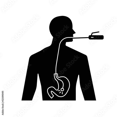 Endoscopy