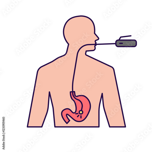 Endoscopy treatment