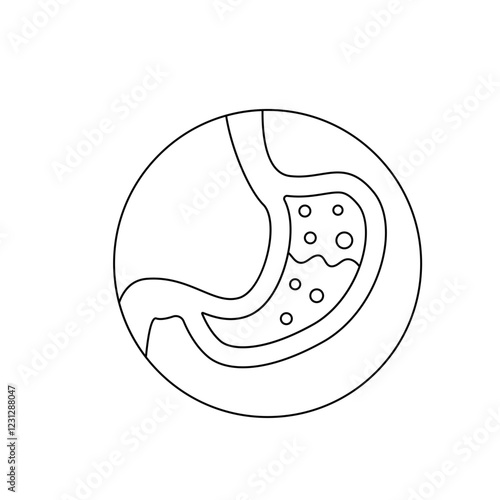 Food poisoning
