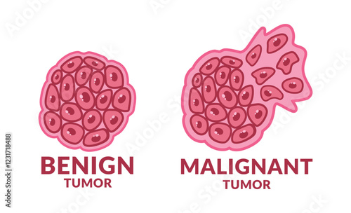 Benign and Malignant Tumor Cancer Cell design vector illustration