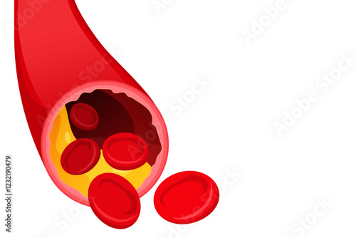Vector image of artery. Arteries with cholesterol. Medical illustration for studying human and his body. Element for your design.