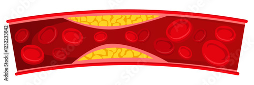 Vector image of artery. Arteries with cholesterol. Medical illustration for studying human and his body. Element for your design.