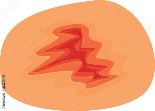 Scar tissue forming a zigzag pattern representing skin damage