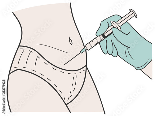 Liposuction surgery on patient's stomach, doctor hand and syringe vector image, Isolated on white background.
