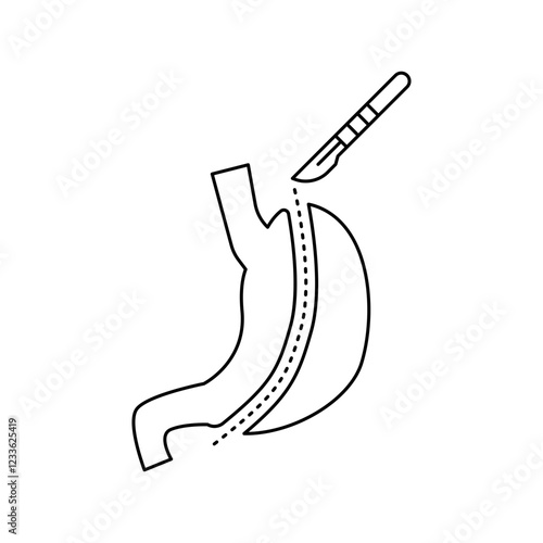 Gastrectomy