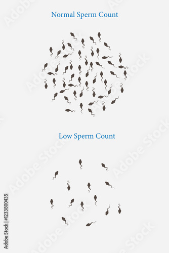 normal and low sperm count illustration. Male infertility oligospermia. Structure of the sperm. Vector. eps 10. medical illustration