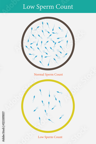 comparison of low sperm count and normal sperm count. eps q0