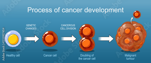 Cancer development from Healthy cell to Malignant tumour.