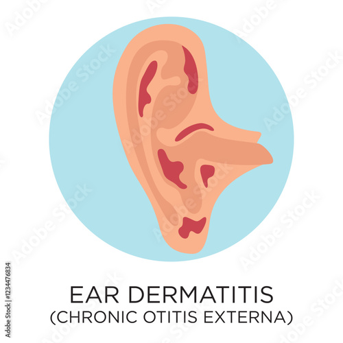 Vector Ear Dermatitis - Chronic Otitis Externa Icon