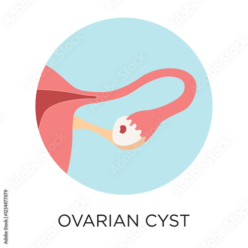 Vector Ovarian Cyst Icon