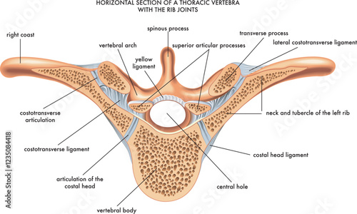 Medical illustration of a horizontal section of a thoracic vertebra, with annotations.