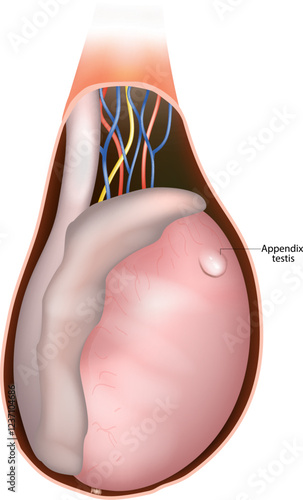 Appendix Testis Anatomy Medical Illustration. Male Reproductive System Cross-Section. Testicular Structure with Appendix Testis. Testicular Appendage