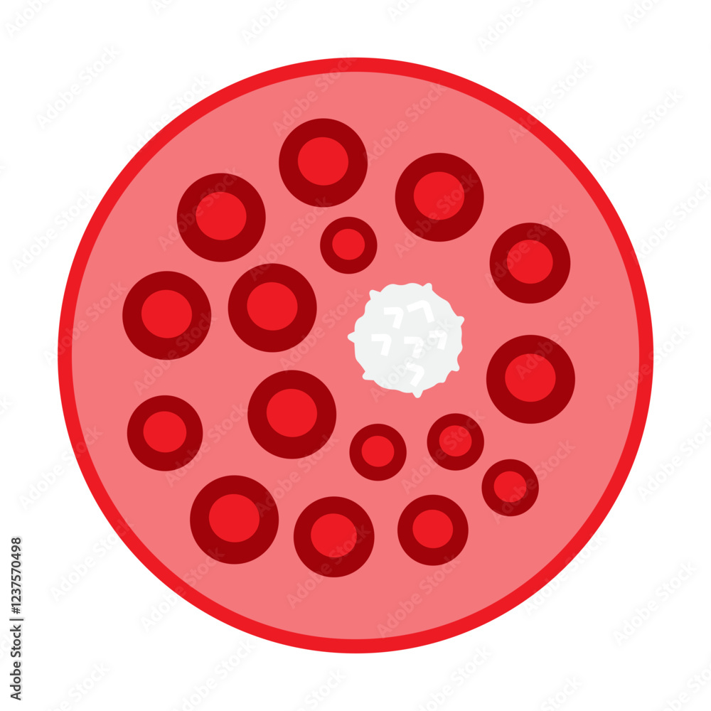 Obraz premium neutropenia 