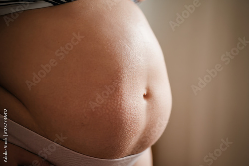 A woman's belly with overweight photo