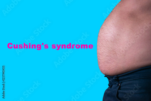 obese man belly fat side view, Cushing's syndrome concept, diabetes concept, man's fat abdomen 