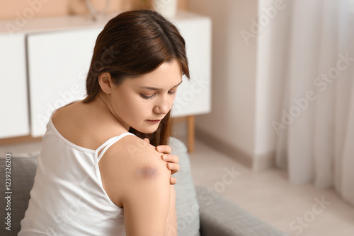Young woman with bruise on ...