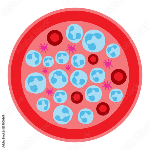neutrophilia