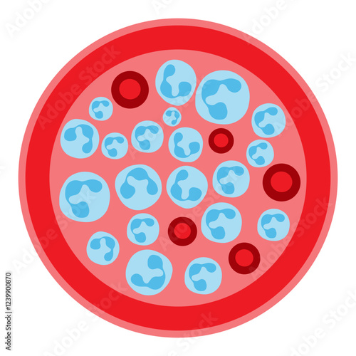 neutrophilia